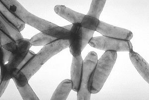 https://upload.wikimedia.org/wikipedia/commons/thumb/7/7d/Legionella_pneumophila_01.jpg/300px-Legionella_pneumophila_01.jpg